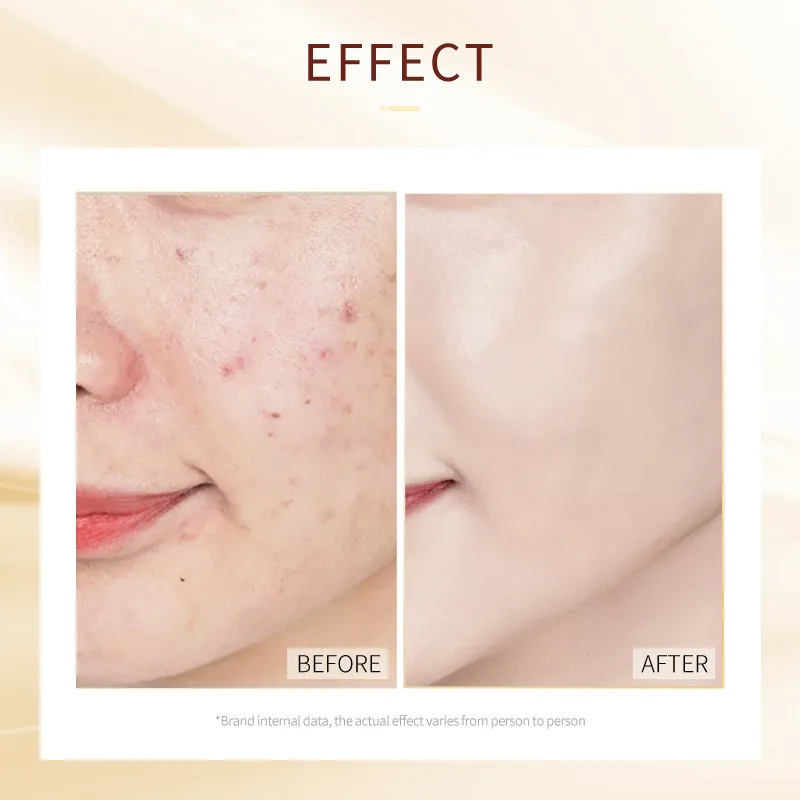 5 шт. увлажняющая маска для лица с экстрактом улитки | Красота и здоровье