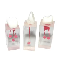 3pcs dental file train rct root canal teeth study practice model endodontic pulp inflammation apical
