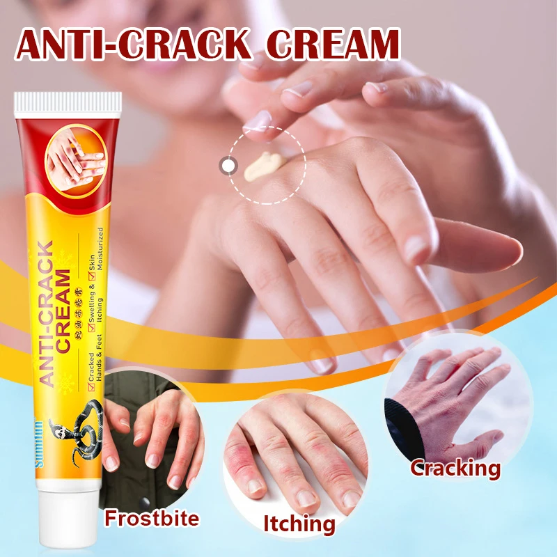 

Chapped Hands And Feet Cream Repair Frostbite Dry Cracked Snakes Oil Plaster Anti-Itch Moisturizing Cream Braces & Supports EK