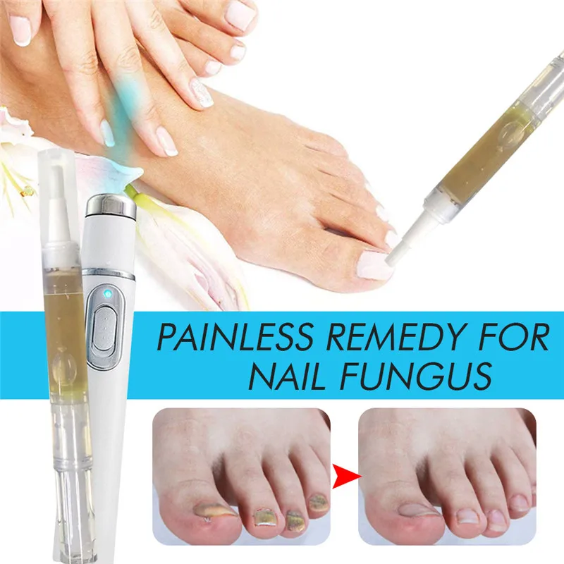 

Hot Blue Light Nail Repair Pen Toenail Nail Care Solutions Pen Set for Fixes and Restores Discolored and Damaged Nails FRE-D