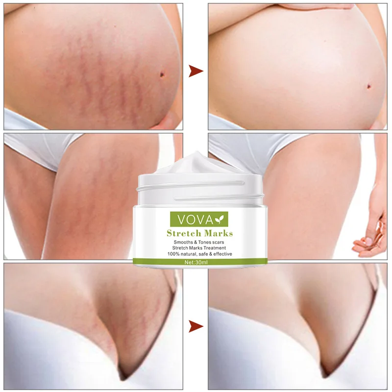 

Stretch Mark Removal Cream To Remove Postpartum Obesity Pregnant Women Repair Anti-aging Anti-wrinkle Firming Body Cream