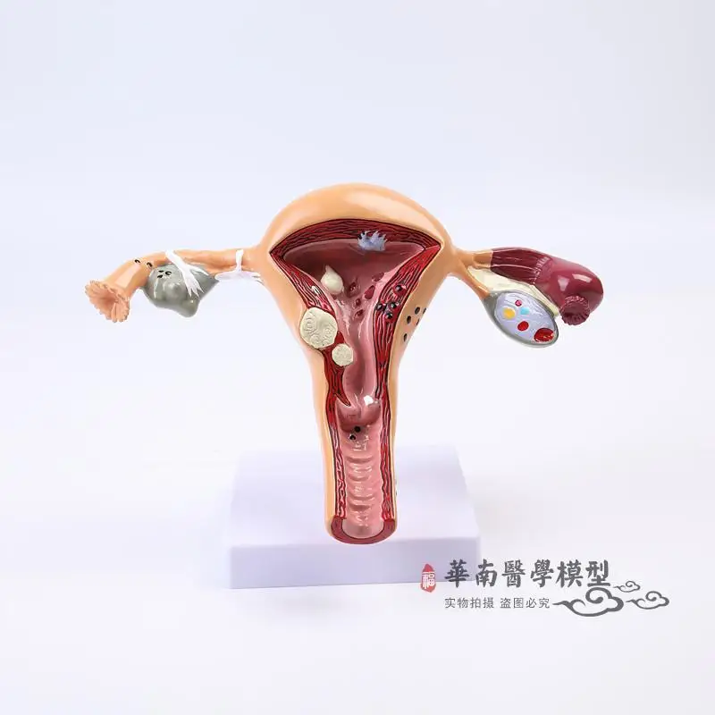 Модель женской анатомии модель репродуктивной матки вагинальный яичников форма
