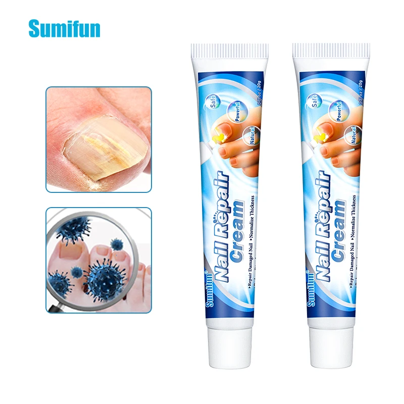 

Восстанавливающий Крем Sumifun для ногтей, крем для пальцев и ног, искусственная мазь против грибка, паронихия, натуральные травы, 20 г