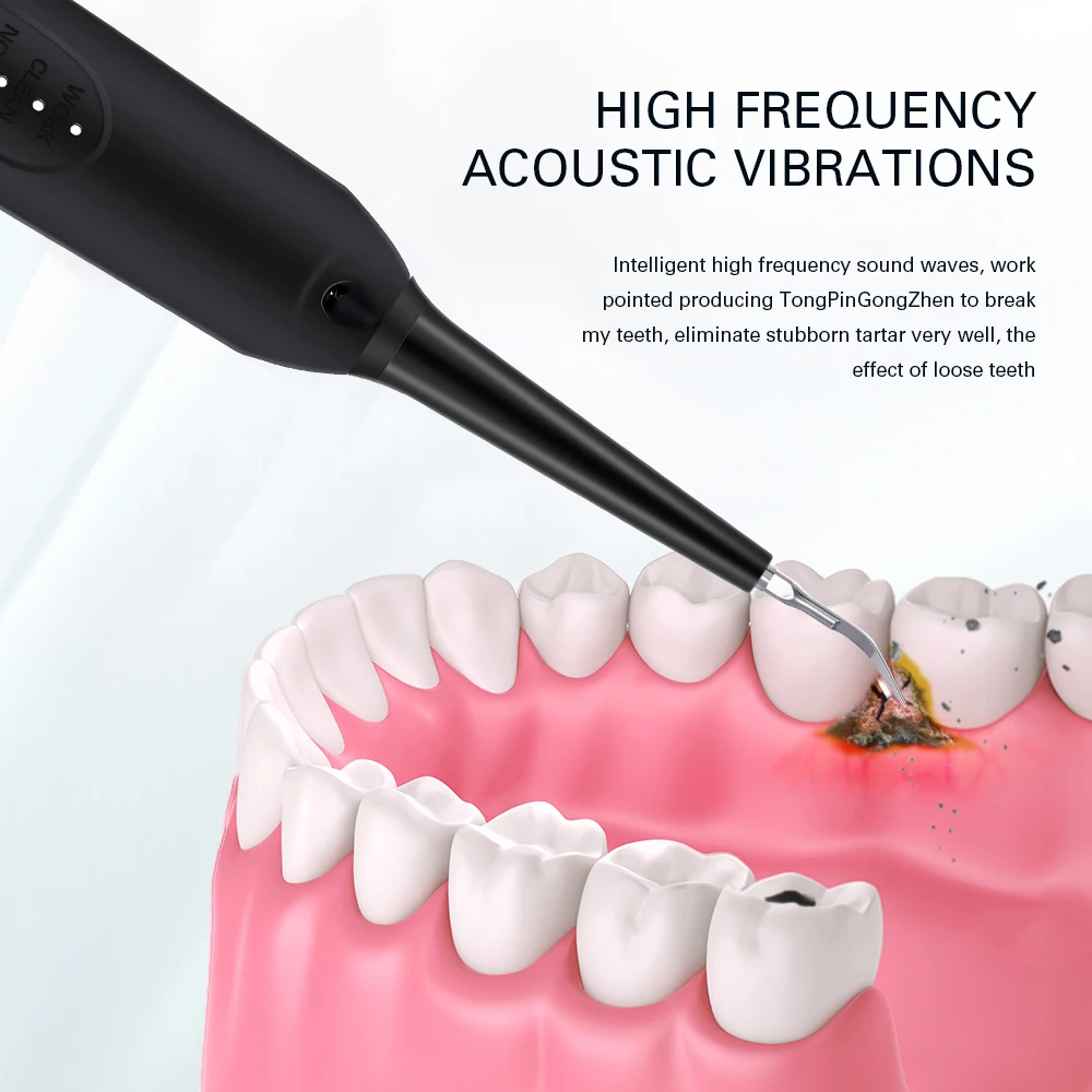 Скребок зубной электрический портативный для отбеливания зубов и орошения