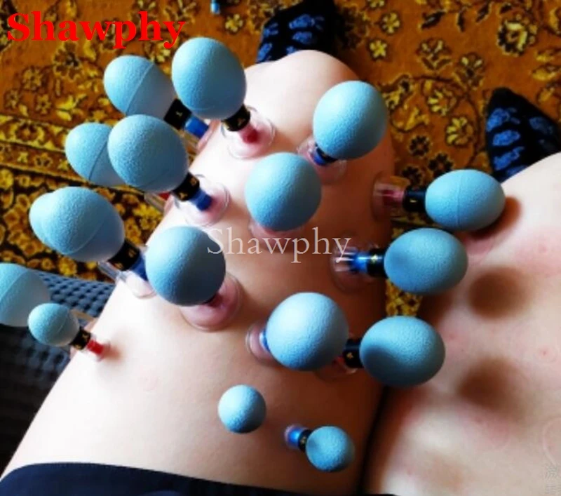 18 шт. серебряный корпус Магнитная терапия присоска бытовой вакуумный Акупрессура иглоукалывание и прижигание набор для ухода за здоровьем