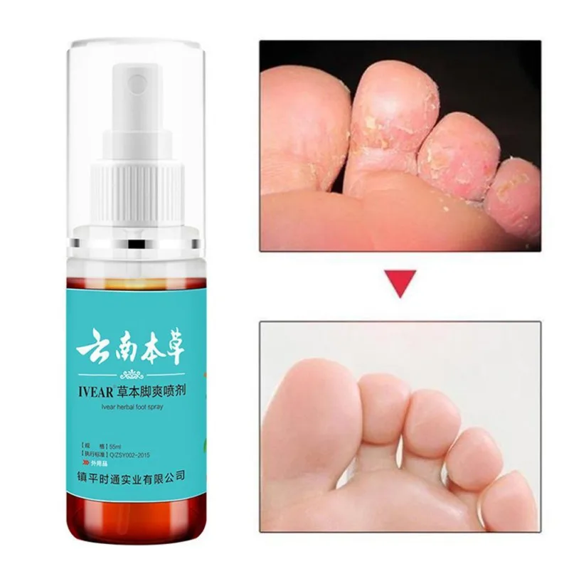 

Травяной Противогрибковый спрей для ног для спортсменов, антибактериальный средство против зуда, пота, запаха, Противогрибковый спрей для ...