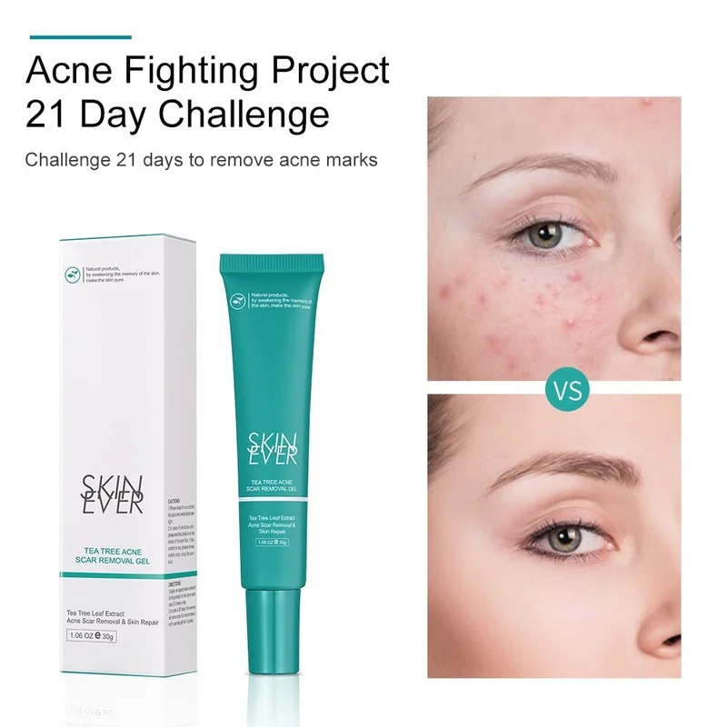 

30g Tea Tree Acne Cream Moisturizing Repair Oil Control Gel To Remove Acne Marks and Fade Facial Treatment Skin Care Products