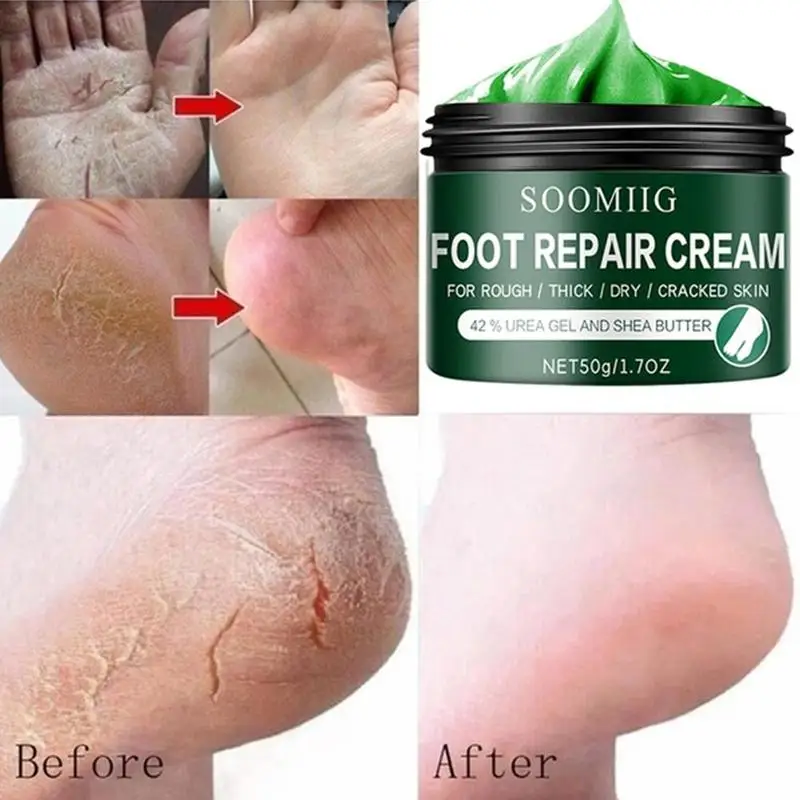 50g Hot Foot Massage Scrub Exfoliating Cream Repai Rough Skin Feet Moisturizing Smooth Care Anti Whitening | Красота и здоровье