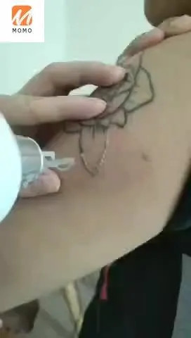 

home Laser tattoo removal system/professional beauty salon used tatoo remover