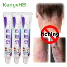 3pcs Skin Care Cream Skin Psoriasis Cream Dermatitis Eczematoid Eczema Ointment Anti-inflammatory Anti Itch Medical Cream A257