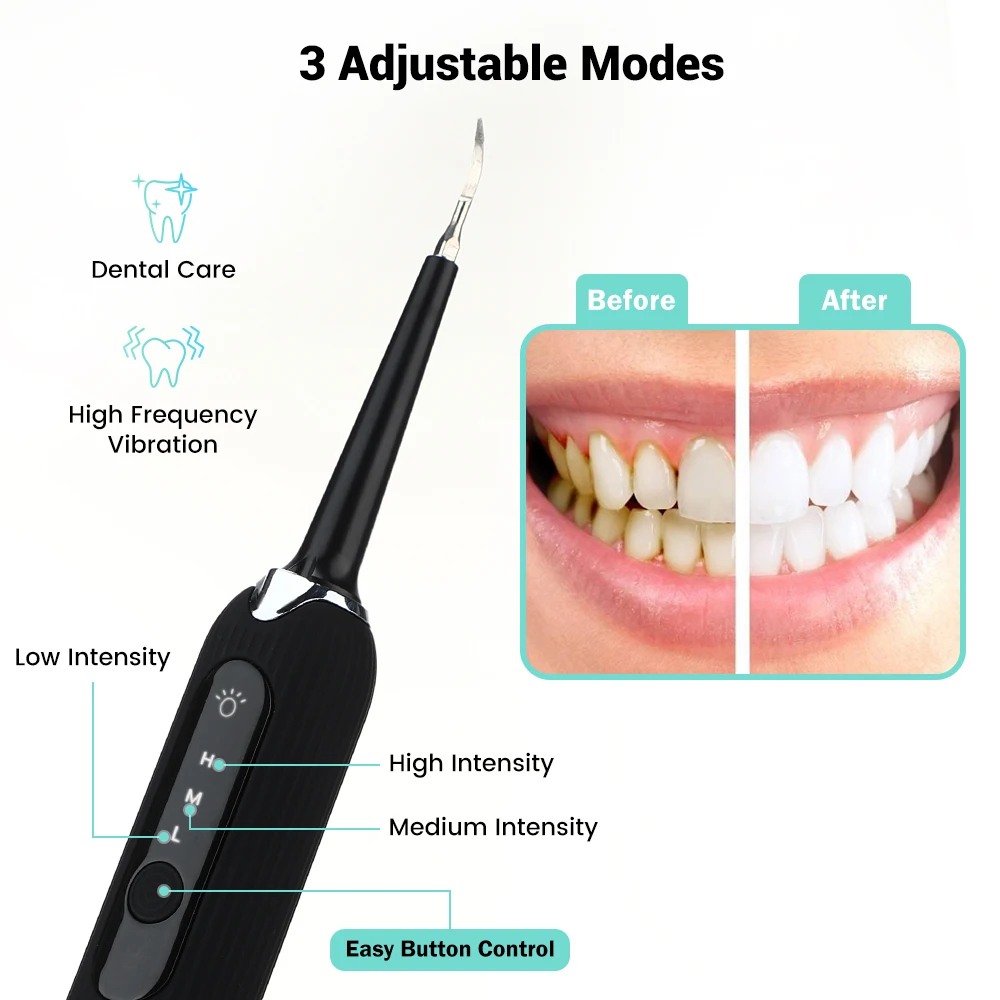 Ultrasonic Calculus Remover Electric Tartar Whitening USB Rechargeable Tooth Cleaner Oral Hygiene Tool | Бытовая техника
