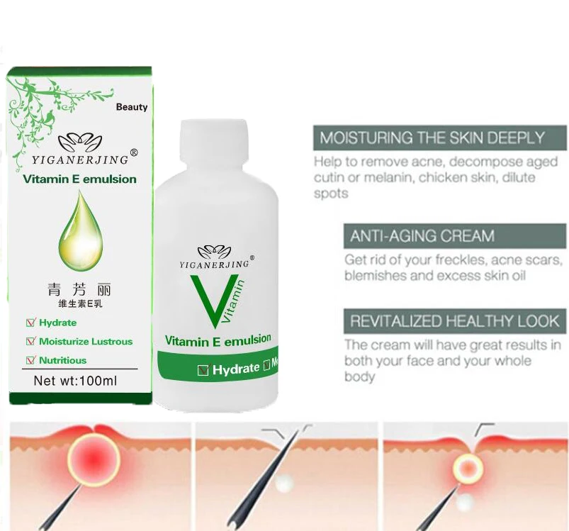 Отверждающий кератоз Pilaris/ Kp/лосьон для кожи курицы и тела крем восстановления