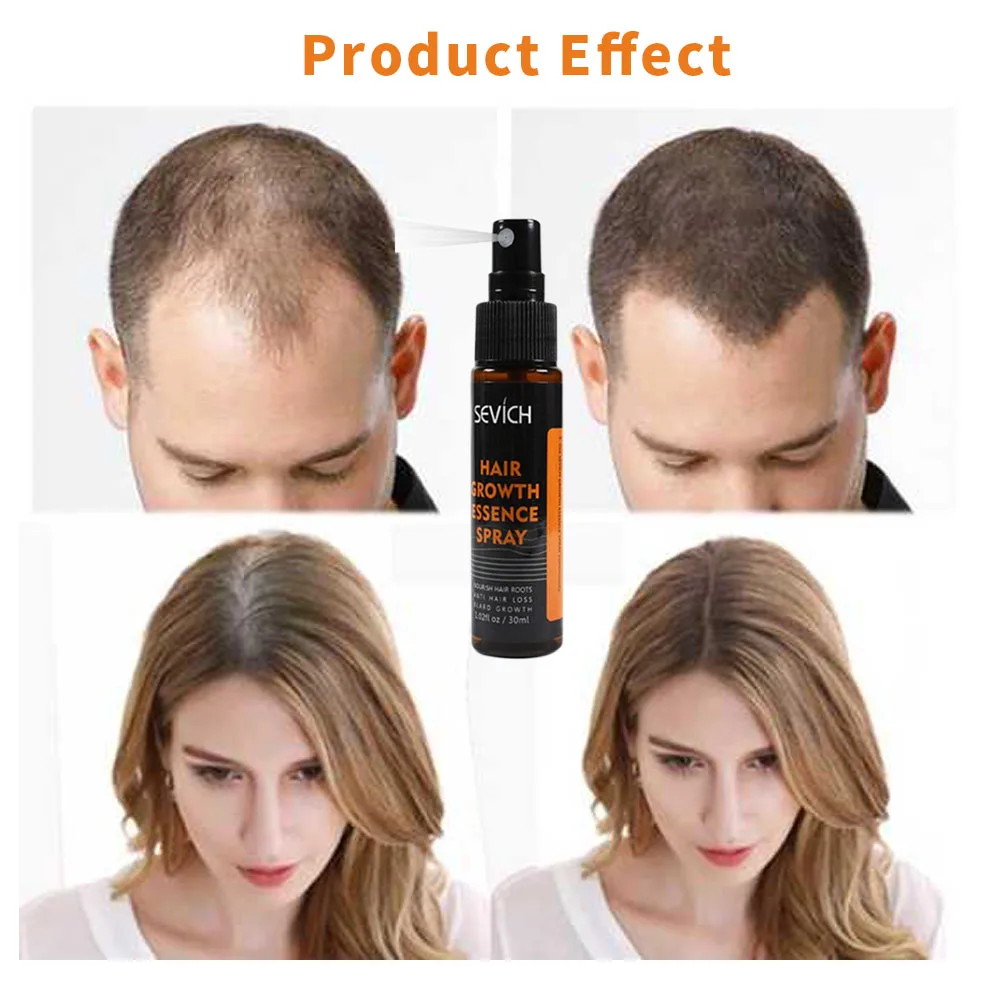 Эссенция для роста волос 30 мл спрей лечения выпадения предотвращения эссенция
