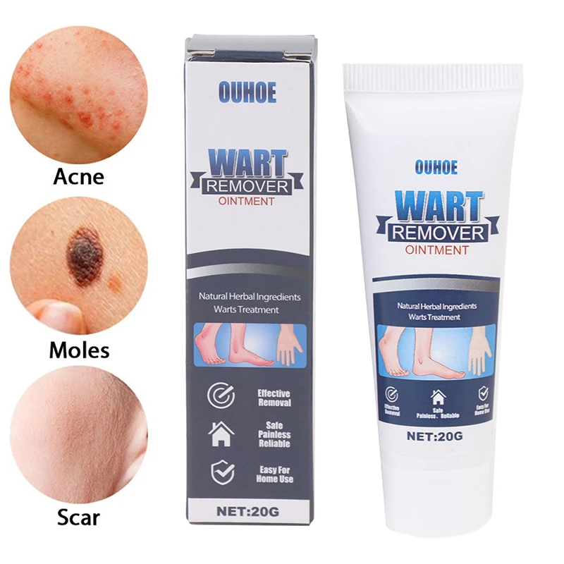

20g Wart Removal Body Warts Treatment Cream Foot Care Cream Skin Tag Remover