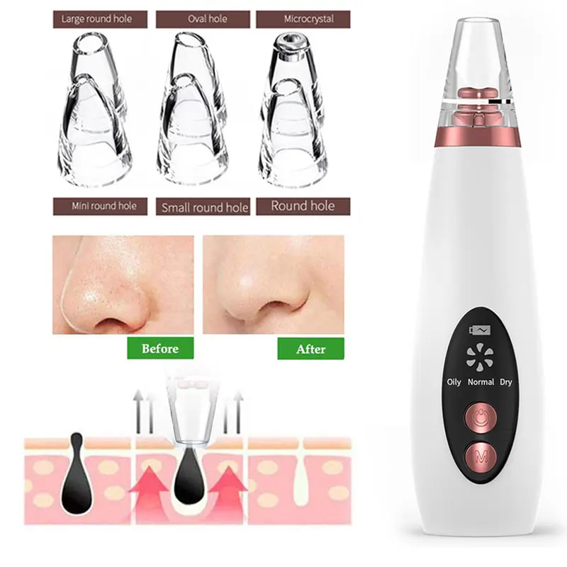 

Clear Skin Care Remove Facial Cleaning Black Head Cleaner ABS Acne Cleaner Blackhead Removal Equipment Effective Fast Fashion