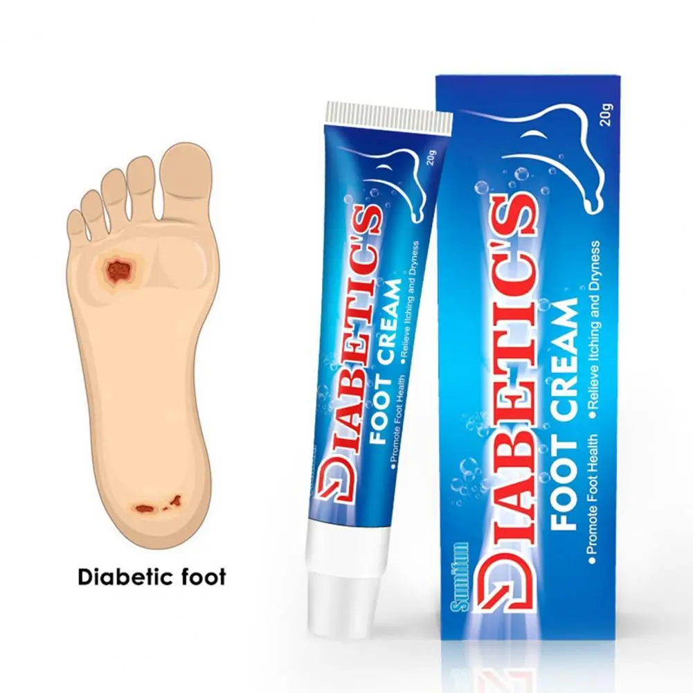 

50% Hot Sale 20g Natural Extract Diabetic Foot Cream Fast Absorption Release Itchy Foot Treatment Anti Inflammation