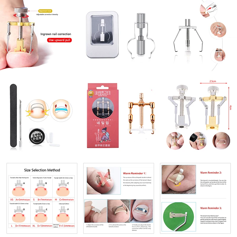

1*Ingrown Toenails Correction Tool Foot Toe Nail Care Tools Straightening Clip Brace Corrector Feet Pedicure Treatment Adjuster