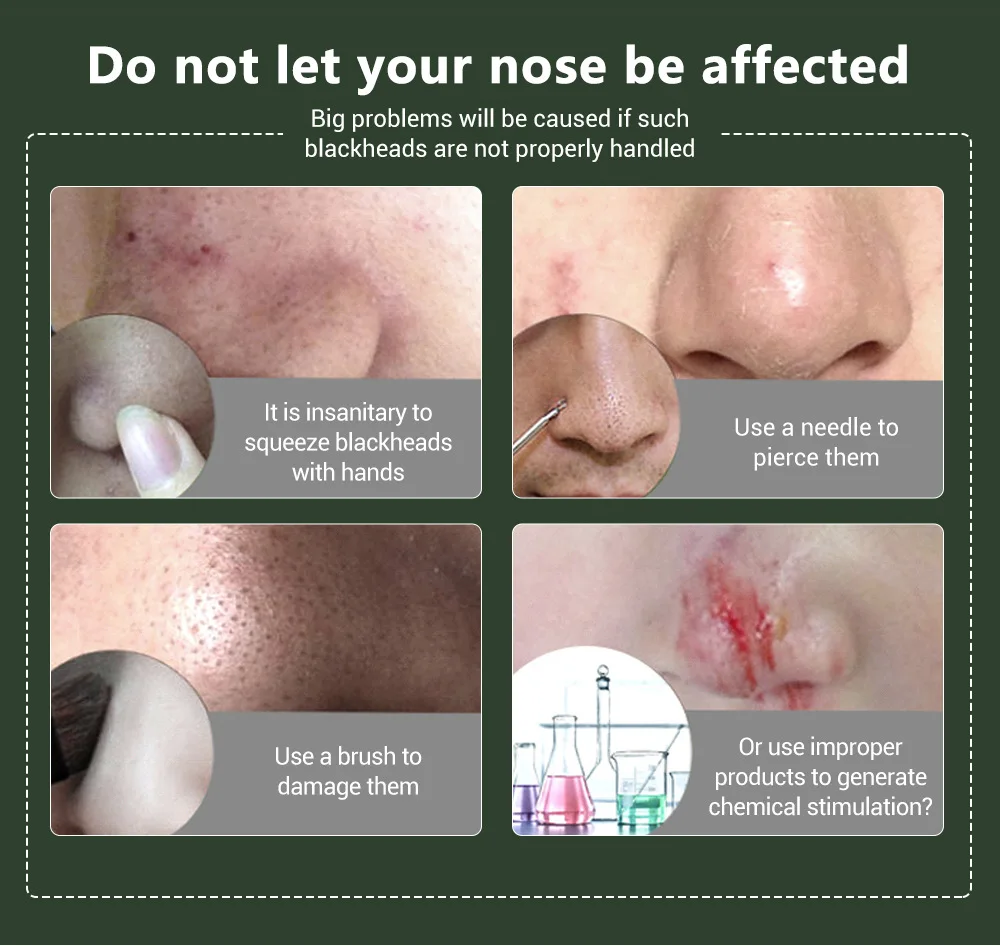 1 шт. маска для удаления черных точек на носу | Красота и здоровье