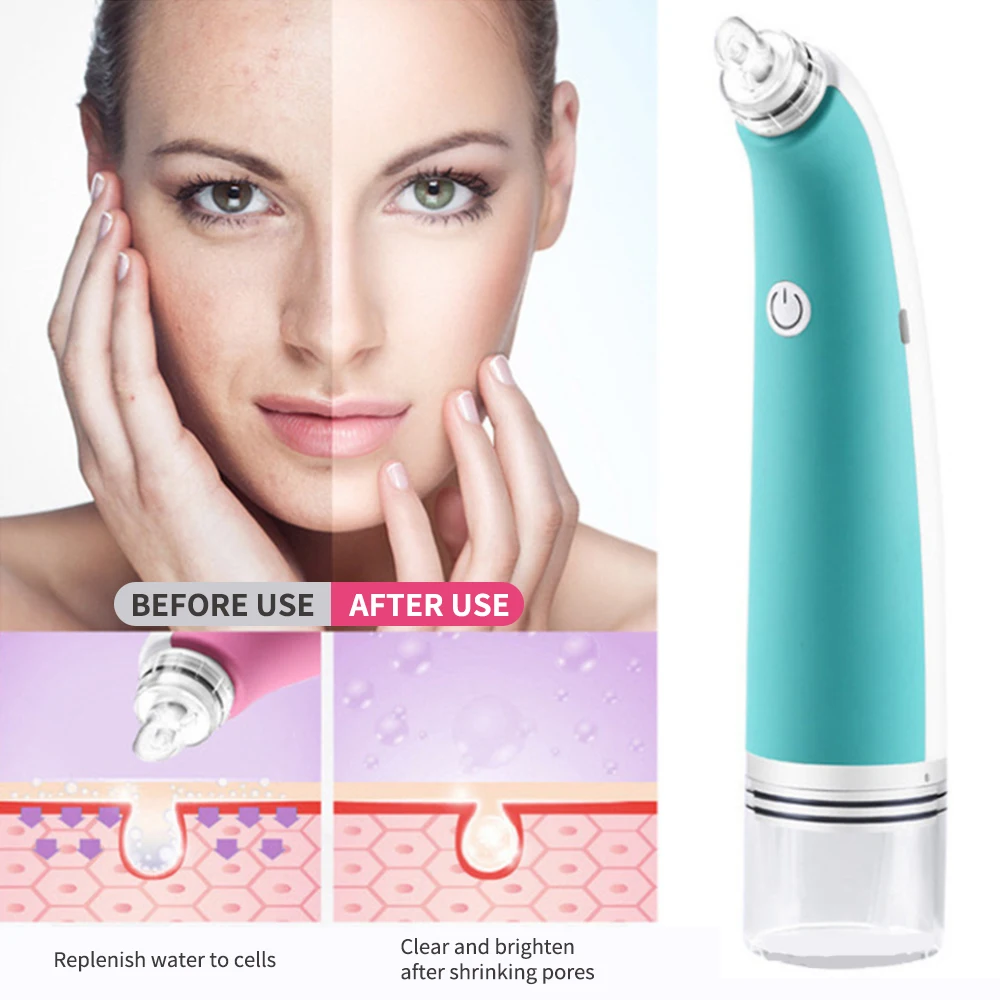 

Electric Bubble Blackhead Remover Nose Cleaner Vacuum Loop Suction Deep Clean Pore Remove Acne Facial Cleaning Skin Care Tool