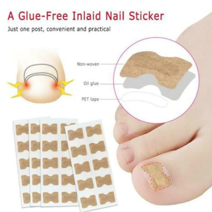 20/60 шт. пластыри для коррекции вросших ногтей | Красота и здоровье