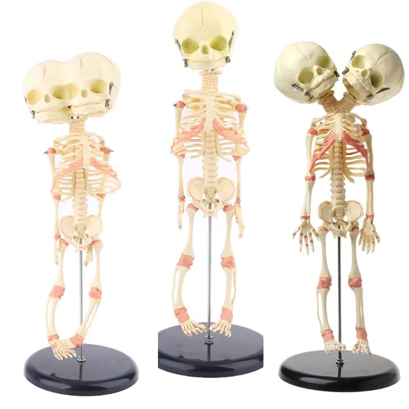 

Human Baby Deformed Head Skull Research Model Skeleton Anatomical Brain Anatomy Teaching Study Display