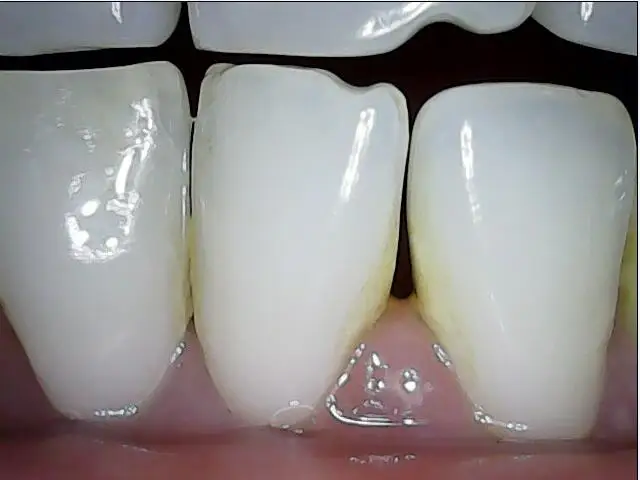 Новая Проводная интраоральная камера для мобильного телефона и смартфона