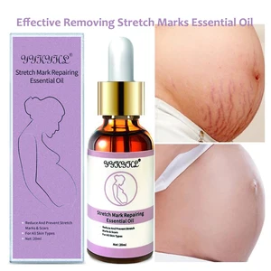 Крем Для Удаления растяжек, эфирное масло для ухода за кожей, для Удаления растяжек, для беременных