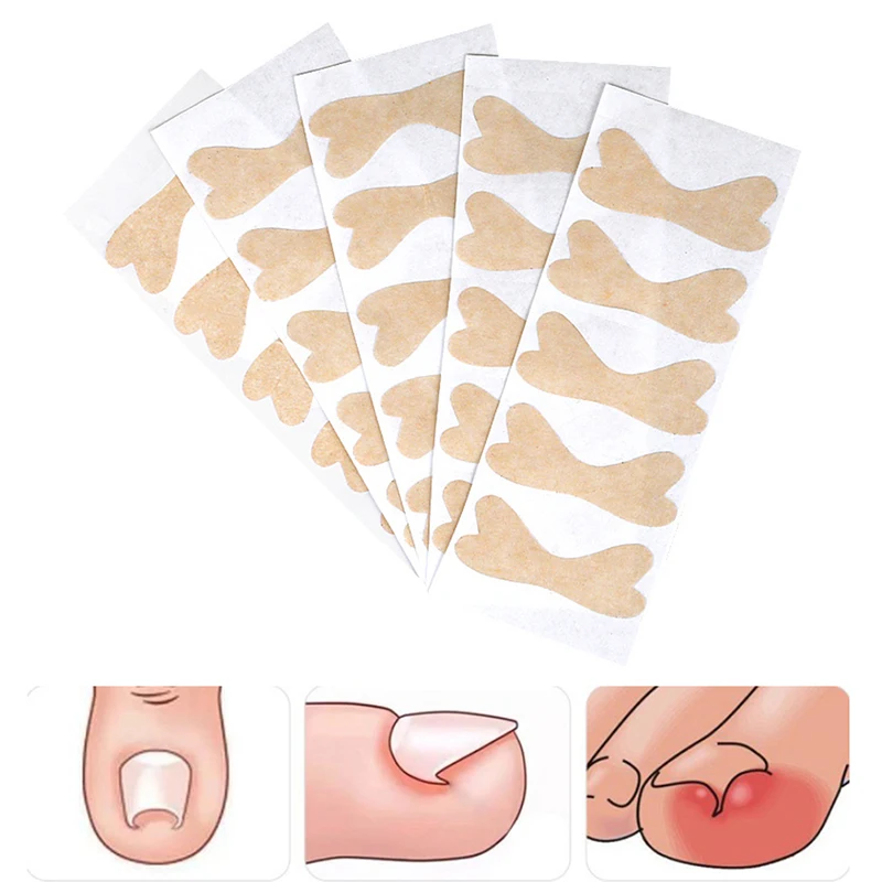 

Ingrown Toenail Corrector Sticker Nail Patch Correction Stickers Paronychia Treatment Recover Corrector Toe Inlay Nail Corrector