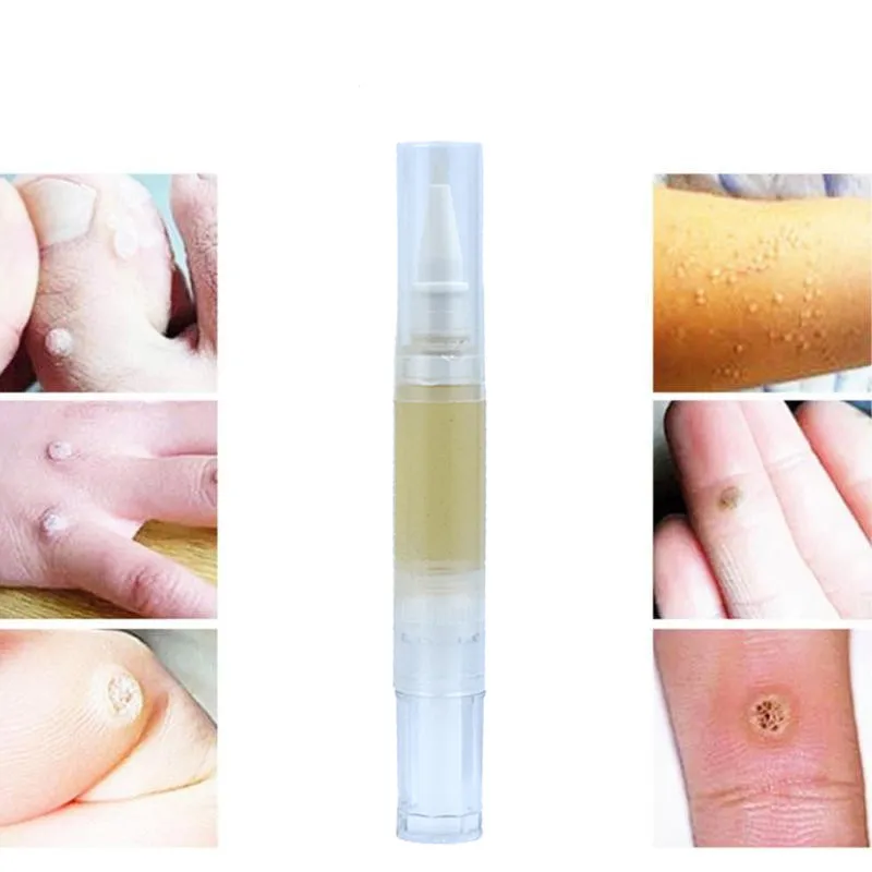 Средство для лечения бородавок жидкость удаления с бирок кожи удаление от бровей