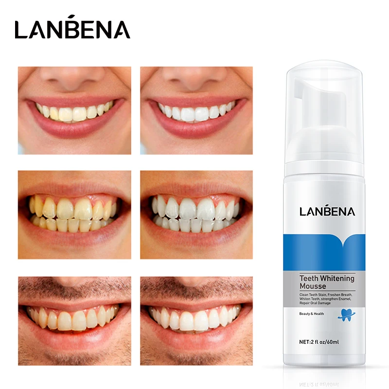 LANBENA отбеливание зубов мусс Отбеливание Зубов Стоматологический Инструмент