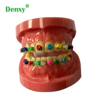 320pcspack dental orthodontic fashion cartoon tie cute ligature tie orthodontic ligatures elastic tie o tie orthodontic bracket