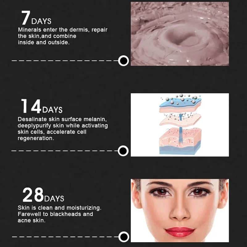 ARTISCARE минеральная грязь + средство для удаления угрей маска лица полоска пор