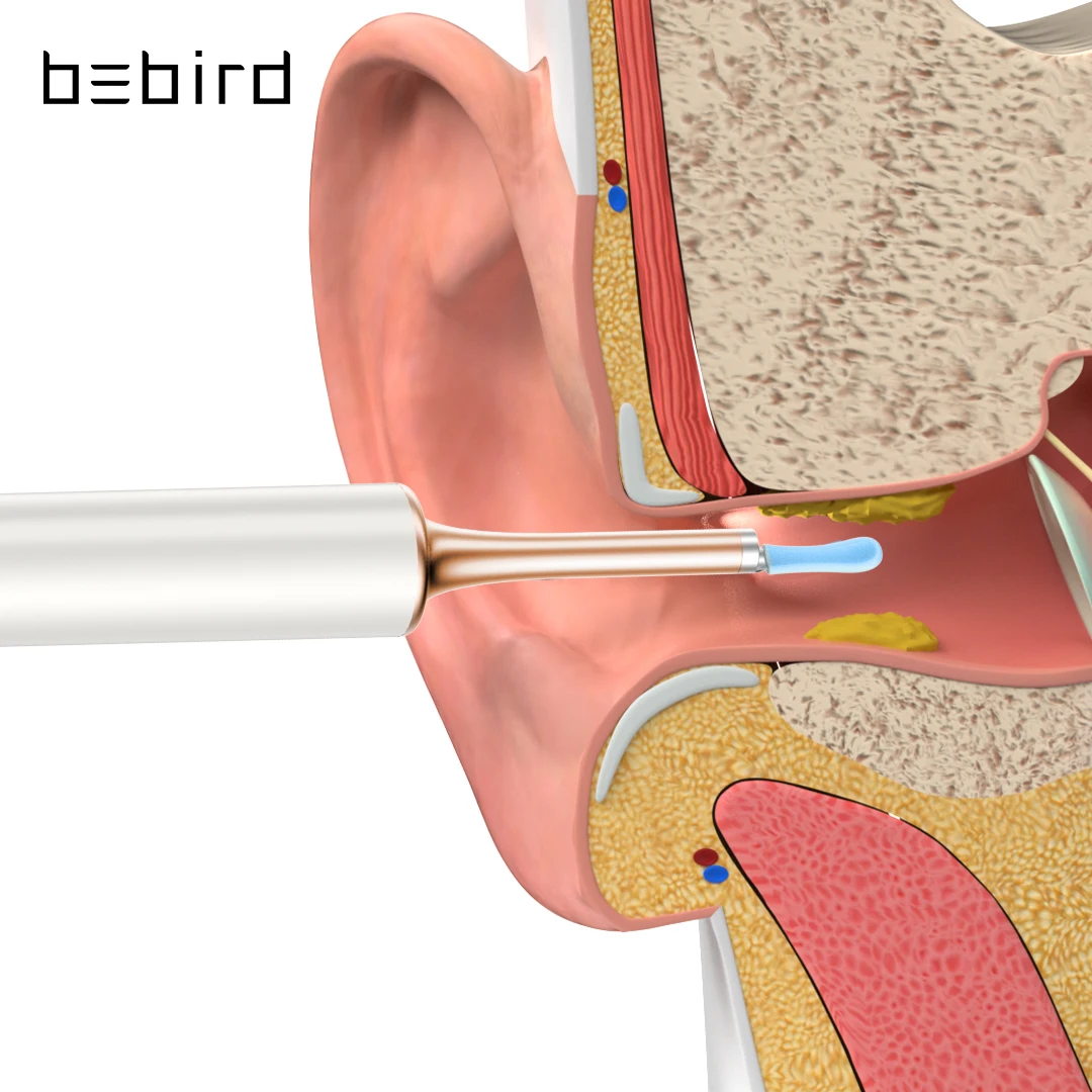 Фото Bebird T15 визуальный очиститель ушей Minifit 2 в 1 инструмент для удаления прыщей и воска Bebird T15 визуальный очиститель ушей Minifit 2 в 1 инструмент для удаления прыщей и воска