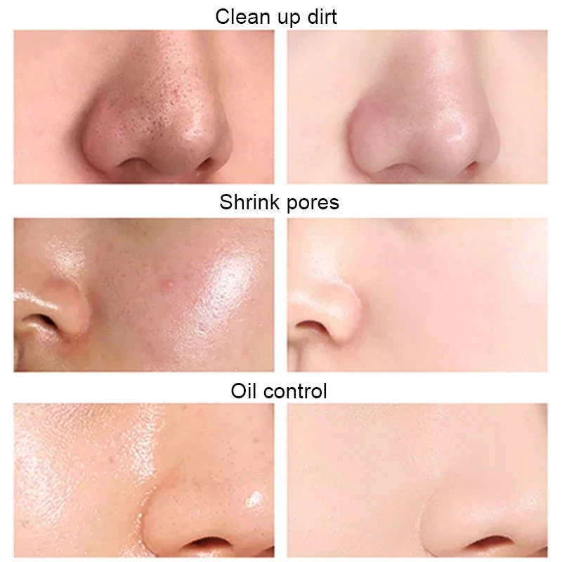 10 шт. маска для лица с экстрактом вишни | Красота и здоровье