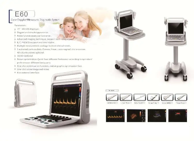Конкурентная цена от производителя ультразвуковой сканер медицинское