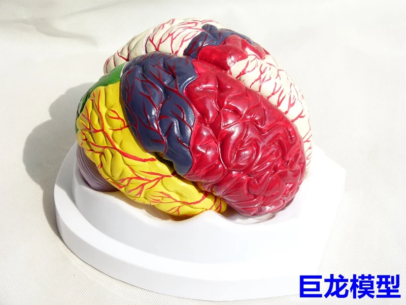 Human color brain detachable Medical teaching model Doctor-patient communication