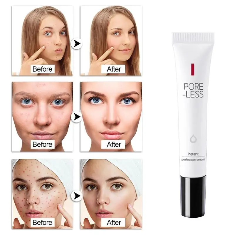 20g Acne Cream Delicate Repair Acne Scar Marks Shrink Face Control Acne Oil Moisturizing Beauty Remove Cream Pores J1A7