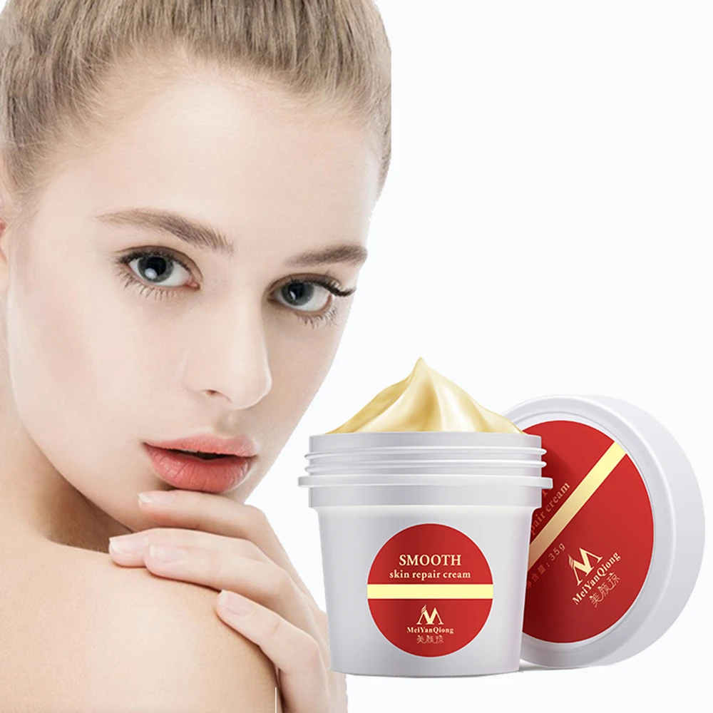 

Крем для тела для удаления растяжек, увлажняющий, уход за кожей, лечение, ремонт, удаление следов, для беременных, Slackline, для беременных