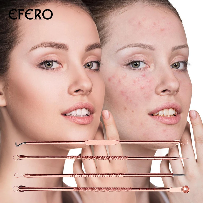 Иглы для угревой сыпи Пинцет лица Чистка Пор Удаление прыщей и косметические