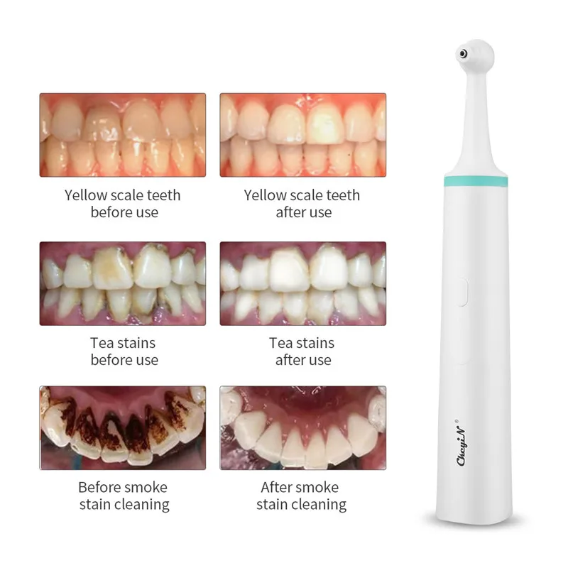 4 In 1 Electric Dental Scaler Tooth Stain Plaque Calculus Remover Teeth Whitening Cleaning Polish Massage with Brush Heads 51 | Бытовая