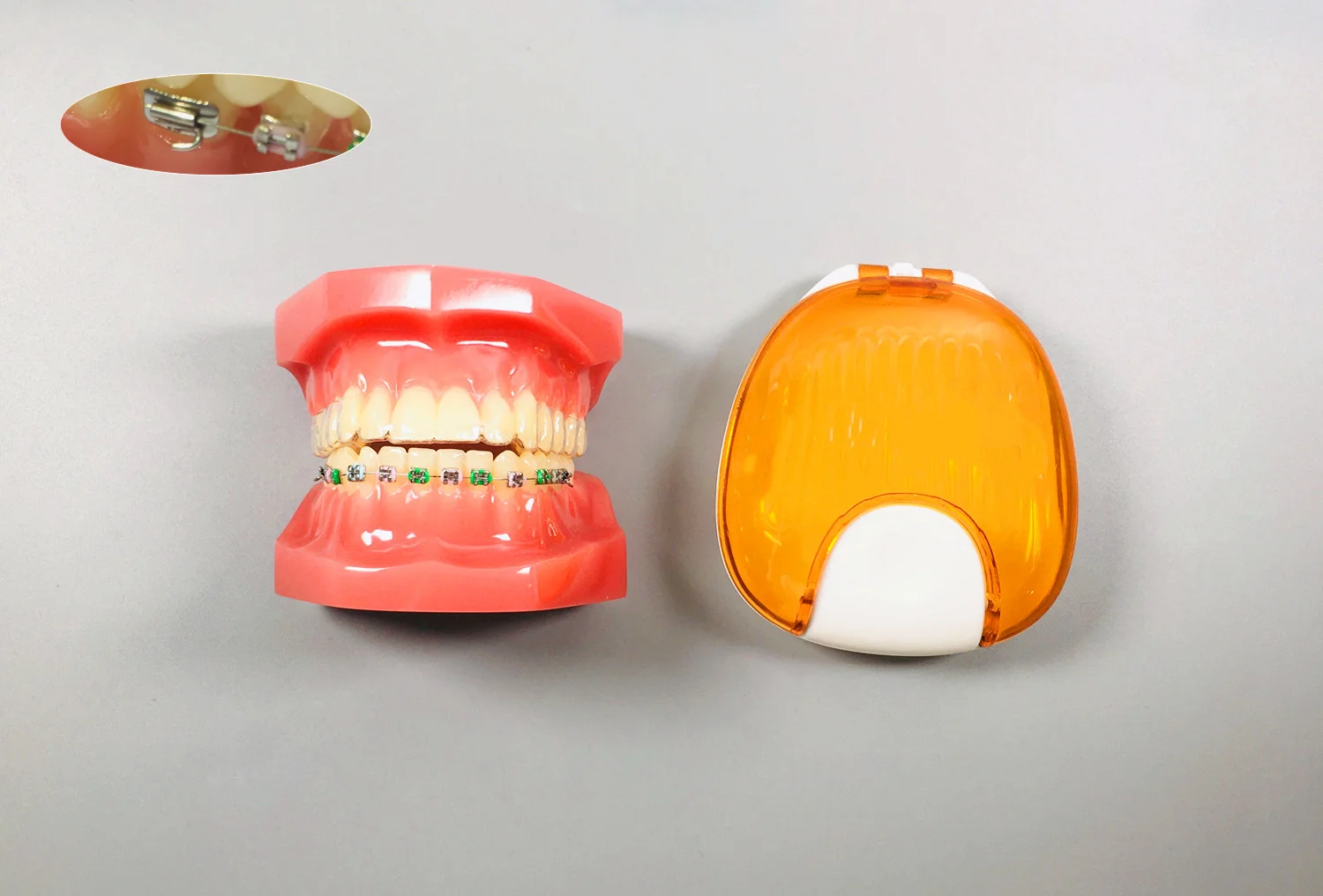 2Pcs Dental Model Invisible Retainer Metal Brackets Contrast Aligner Comparison Study