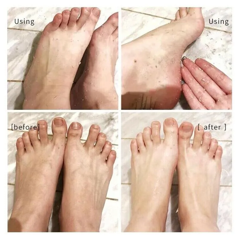 

110ml Natural Orange Essence Foot Exfoliating Beauty Dead Foot Exfoliator Skin Mask Care Hands Tool Pedicure Foot Spray A7J4