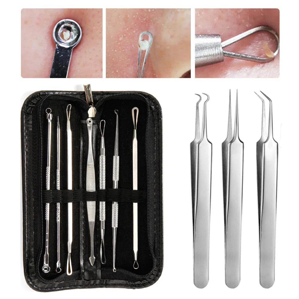 7/10 шт./компл. инструменты для удаления угрей пинцет из нержавеющей стали прыщи