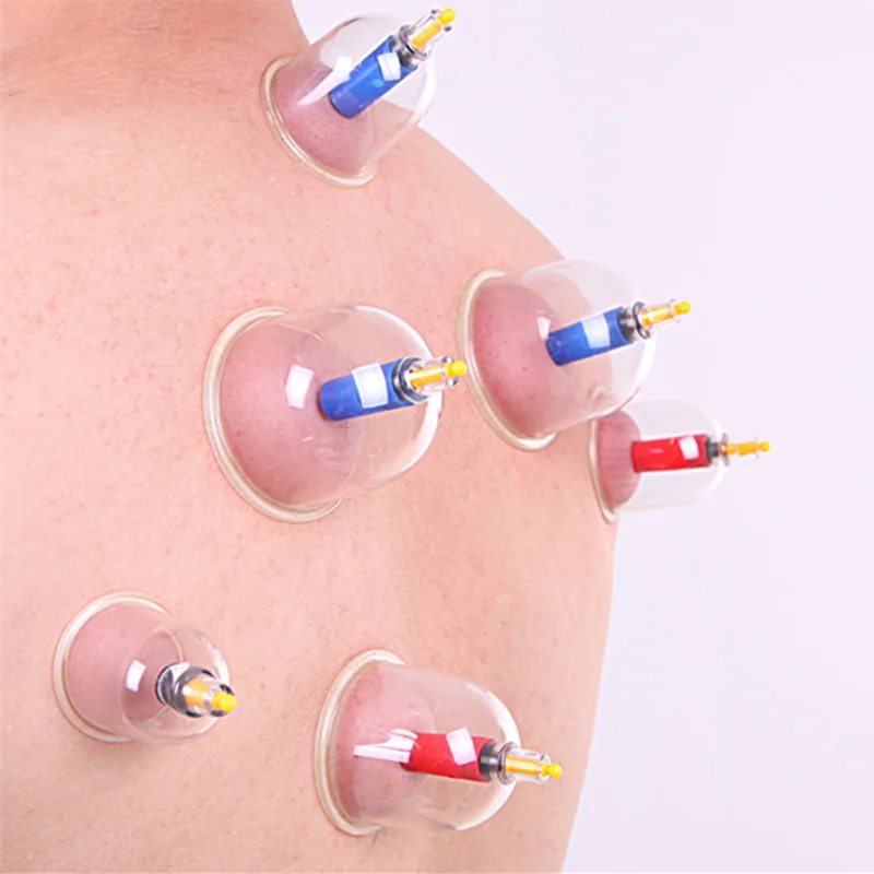 Утолщенные вакуумные чашки для массажа 18 шт.|Лечение с помощью медицинских банок|