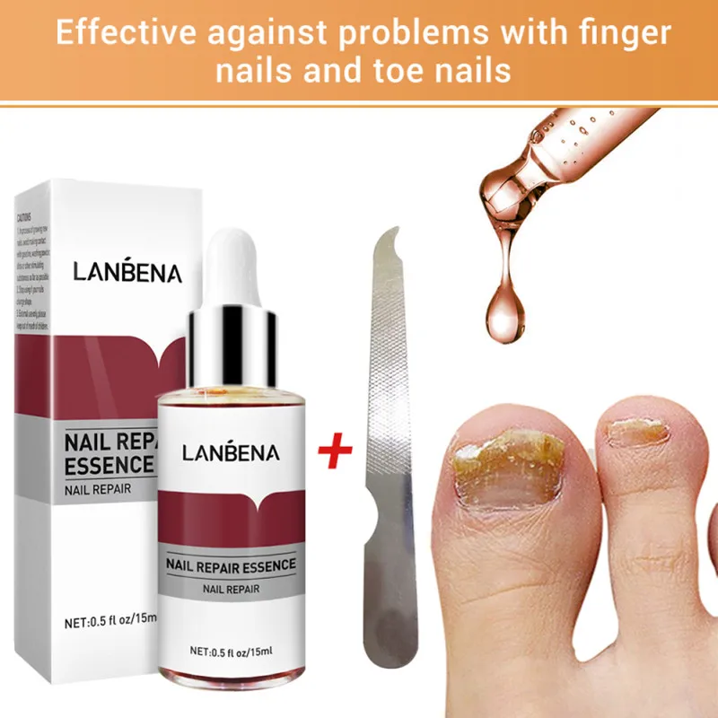 

LANBENA Fungal Nail Repair Serum Paronychia Onychomycosis Toe Nourishing Brighten Treatments Care Foot Nail Fungus Removal Gel