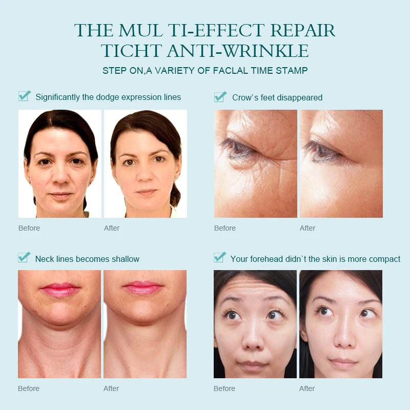 AUQUEST шесть эссенция с пептидами укрепляющий увлажняющий отбеливающий крем для