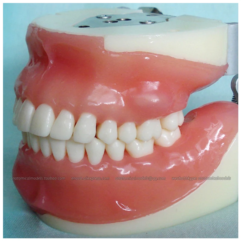 

CMAM/12608 стоматологический гингивит, медицинская анатомическая модель для обучения ротовой полости