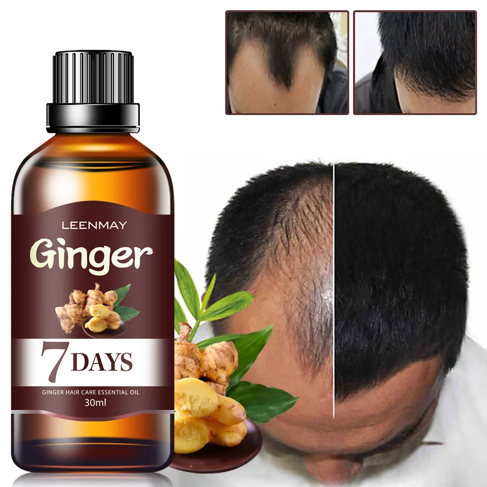 

7 Days Fast Hair Growth Essence Oil Ginger Hair Growth Serum Nourish Treatment Hair Loss Repair Damaged Hair For Men Women 30ml