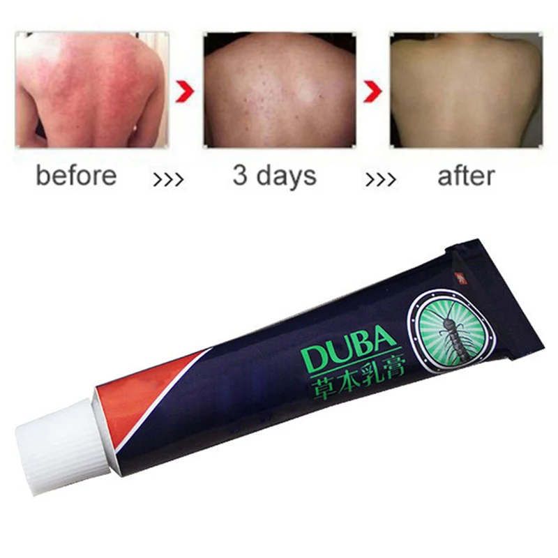 

Крем для тела от псориаза идеально подходит для дерматита и экземы зуд псориаз травяная мазь тюбик для крема can CSV