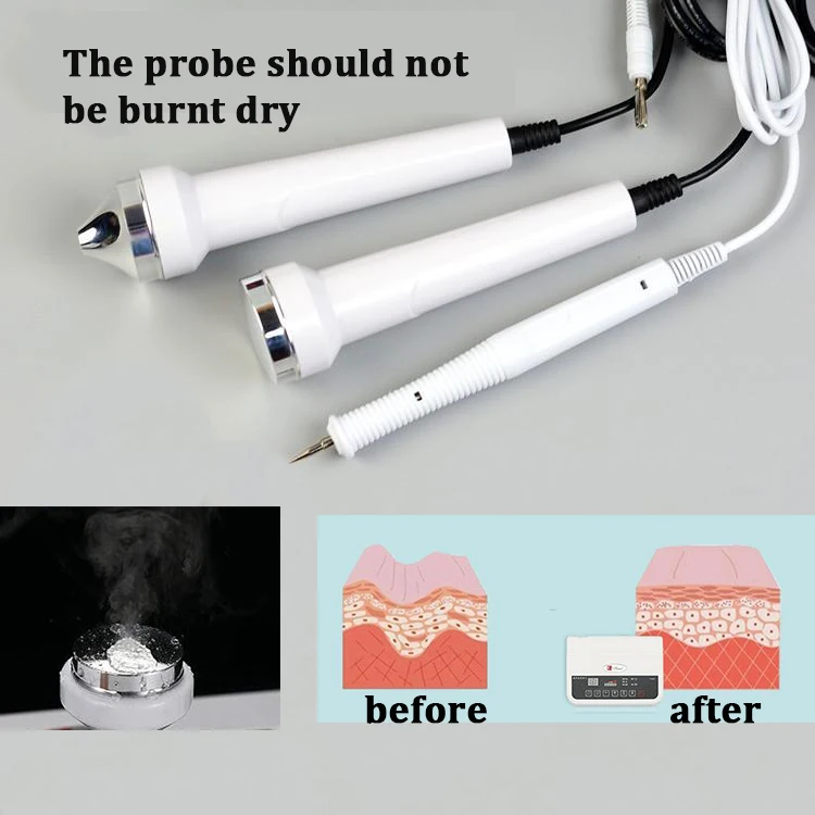 Микрокомпьютер ультразвуковое устройство для удаления морщин лечения акне